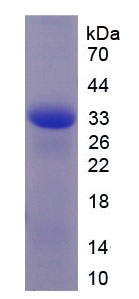 Recombinant Cluster Of Differentiation 147 (CD147)