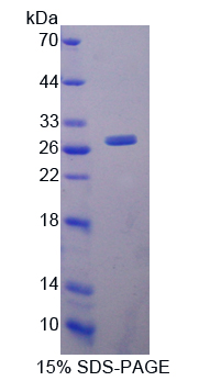 Recombinant Lymphocyte Function Associated Antigen 1 Alpha (CD11a)