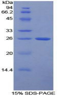Recombinant Cluster Of Differentiation 64 (CD64)