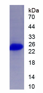 Recombinant Cluster Of Differentiation 23 (CD23)