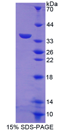 Recombinant Lymphocyte Antigen 75 (LY75)