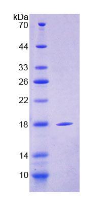 Recombinant Cluster Of Differentiation 209 (CD209)