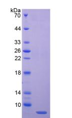 Recombinant C4 Binding Protein Alpha (C4BPa)