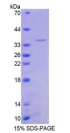 Recombinant Transforming Growth Factor Beta Stimulated Protein Clone 22 (TSC22)