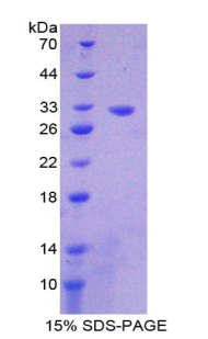 Recombinant Citrate Synthase (CS)