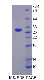 Recombinant Lymphocyte Activation Gene 3 (LAG3)