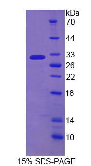 Recombinant Cluster Of Differentiation 226 (C<b>D226</b>)