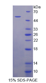 Recombinant Protein Kinase, AMP Activated Beta 1 (PRKAb1)
