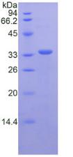 Recombinant Cluster Of Differentiation (CD163)