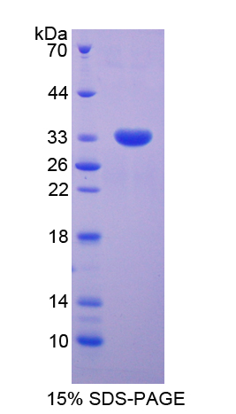 Recombinant Signal Transducer And Activator Of Transcription 5B (STAT5B)