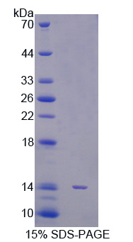 Recombinant Signal Transducer And Activator Of Transcription 5A (STAT5A)