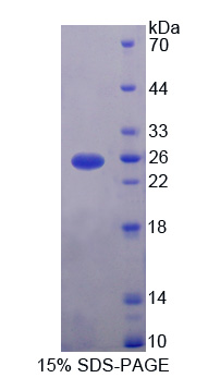 Recombinant CUB Domain Containing Protein 1 (CDCP1)