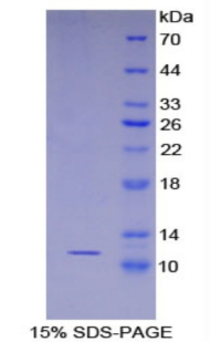 Recombinant S100 Calcium Binding Protein A8 (S100A8)