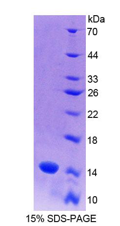 Recombinant S100 Calcium Binding Protein A9 (S100A9)