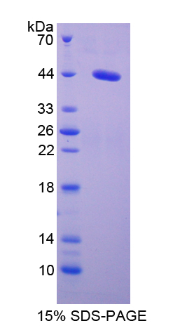 Recombinant Serum Amyloid A2 (SAA2)