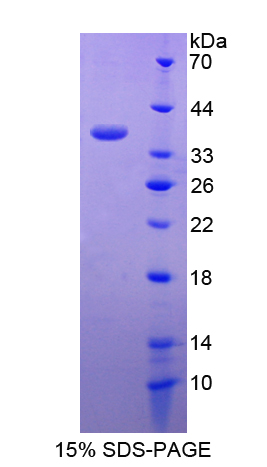 Recombinant Small Breast Epithelial Mucin (SBEM)
