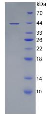 Recombinant Cluster Of Differentiation 19 (CD19)