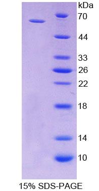 Recombinant Cluster Of Differentiation 19 (CD19)