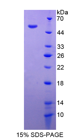 Recombinant Mannose Associated Serine Protease 1 (MASP1)