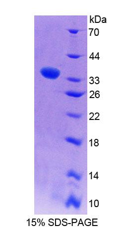 Recombinant Wiskott Aldrich Syndrome Protein (WASP)