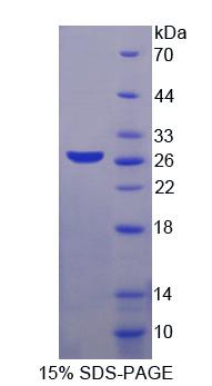 Recombinant Melanoma Antigen Family A1 (MAGEA1)