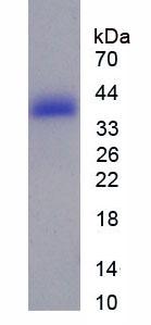 Recombinant Tau Protein (MAPT)
