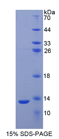 Recombinant S100 Calcium Binding Protein A2 (S100A2)