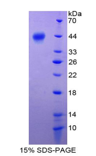 Recombinant S100 Calcium Binding Protein A2 (S100A2)