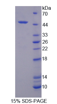 Recombinant Platelet Activating Factor Acetylhydrolase 2 (PAFAH2)