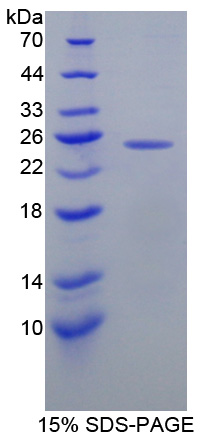 Recombinant O-6-Methylguanine DNA Methyltransferase (MGMT)