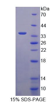 Recombinant Asialoglycoprotein Receptor 2 (ASGR2)