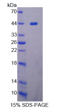 Recombinant Latent Transforming Growth Factor Beta Binding Protein 1 (LTBP1)
