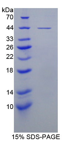 Recombinant Latent Transforming Growth Factor Beta Binding Protein 1 (LTBP1)