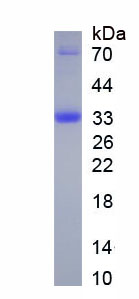 Recombinant Collagen Type XII (COL12)
