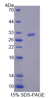 Recombinant HLA Class II Histocompatibility Antigen, DRB1 Beta Chain (HLA-DRB1)