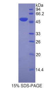 Recombinant Left/Right Determination Factor 1 (LEFTY1)