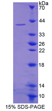 Recombinant Poly A Specific Ribonuclease (PARN)