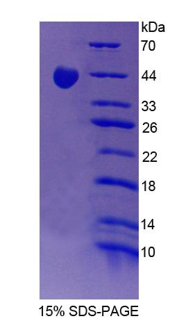 Recombinant Protein Phosphatase 1, Regulatory Subunit 15A (PPP1R15A)
