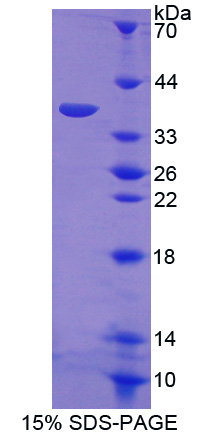 Recombinant E1A Binding Protein P300 (EP300)