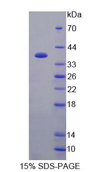 Recombinant Amyloid Beta Precursor Protein Binding Protein 1 (APPBP1)