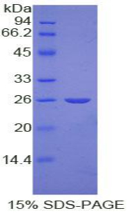 Recombinant Nucleolin (NCL)
