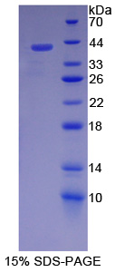 Recombinant Heterogeneous Nuclear Ribonucleoprotein A1 (HNRNPA1)