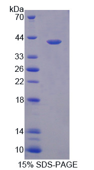 Recombinant Heterogeneous Nuclear Ribonucleoprotein A1 (HNRNPA1)