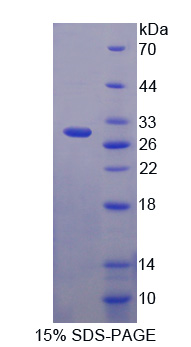 Recombinant Nucleoporin 62 (NUP62)