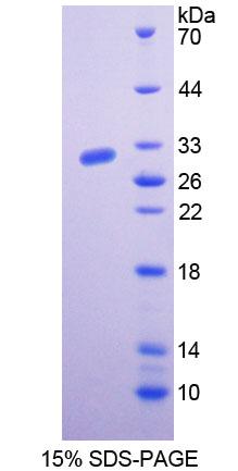 Recombinant Butyrylcholinesterase (BCHE)
