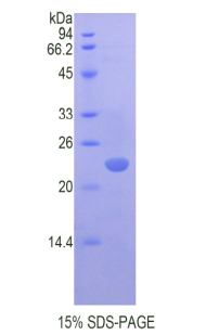 Recombinant Chromobox Homolog 3 (CBX3)