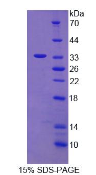 Recombinant Centrosomal Protein 110kDa (CEP110)