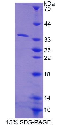 Recombinant Carboxylesterase 1 (CES1)