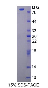 Recombinant Carnitine Palmitoyltransferase 2, Mitochondrial (CPT2)