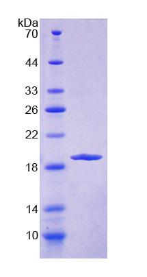 Recombinant Endoplasmic Reticulum Protein 29 (ERP29)